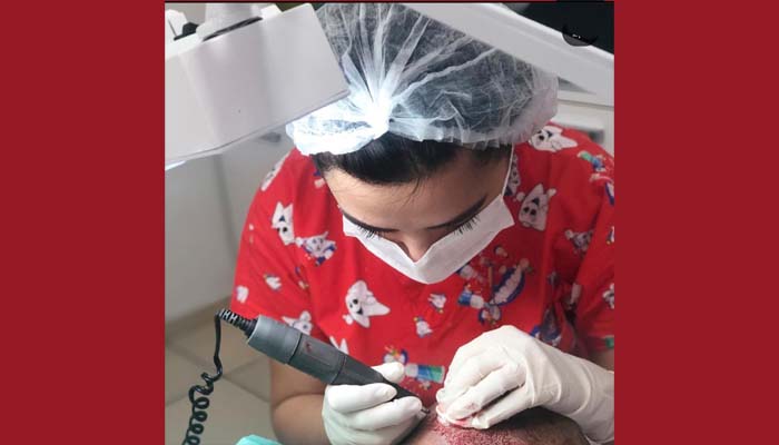 O Çiçeği burnunda bir saç ekim uzmanı