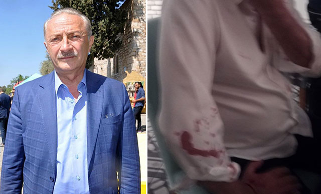 Belediye Başkanına beyzbol sopalı saldırı