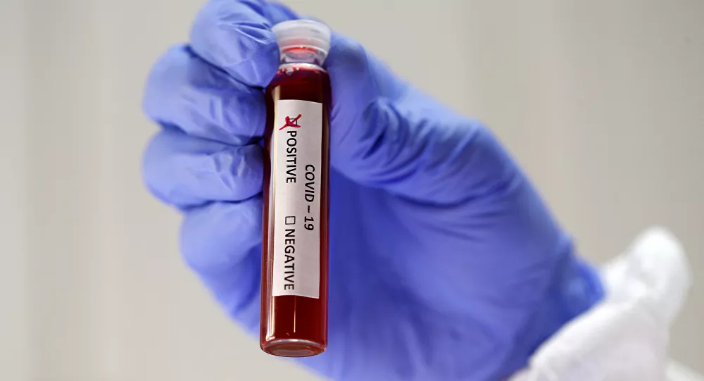 22 bin 291 yeni vaka, 76 ölüm