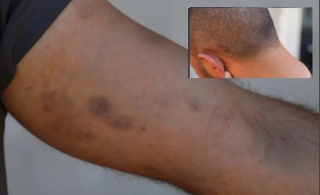 Konya'da katliam yerine giden akrabalar: Polis bizi darp etti