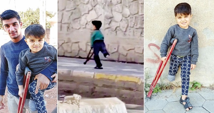 Görüntüleri ses getirmişti; Rojavalı çocuk protez bacağa kavuşacak