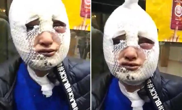 Eski sözlüsüne cinsel saldırıda bulunup başından aşağı kızgın yağ döken şüpheli tutuklandı