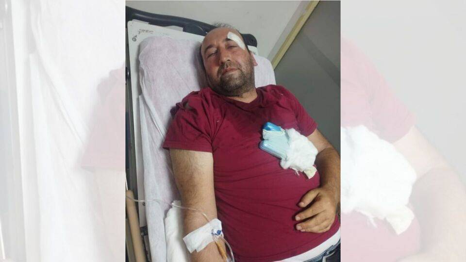 Viranşehir'de gazeteciye darp ve tehdit: Belediyeyle ilgili bir şey yazarsan ölürsün