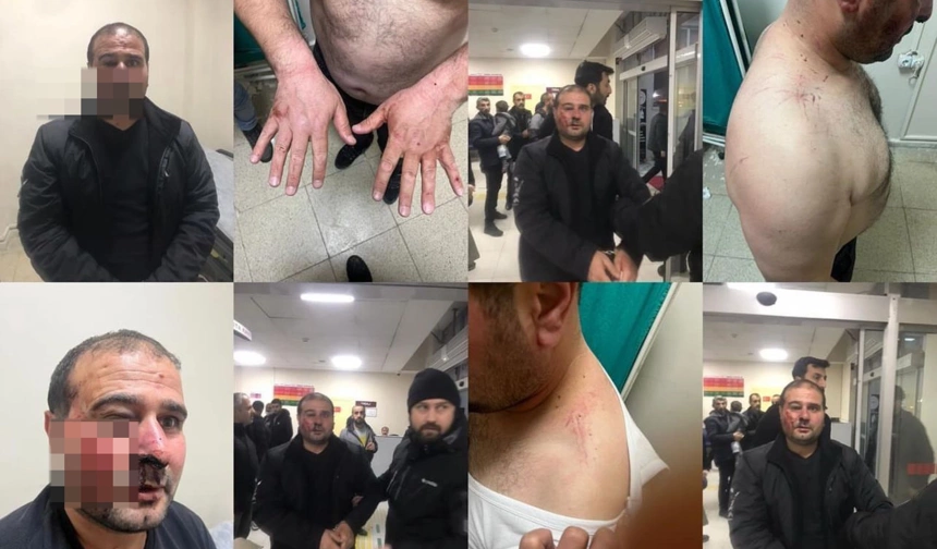 Hakkari valiliğinden darp açıklaması