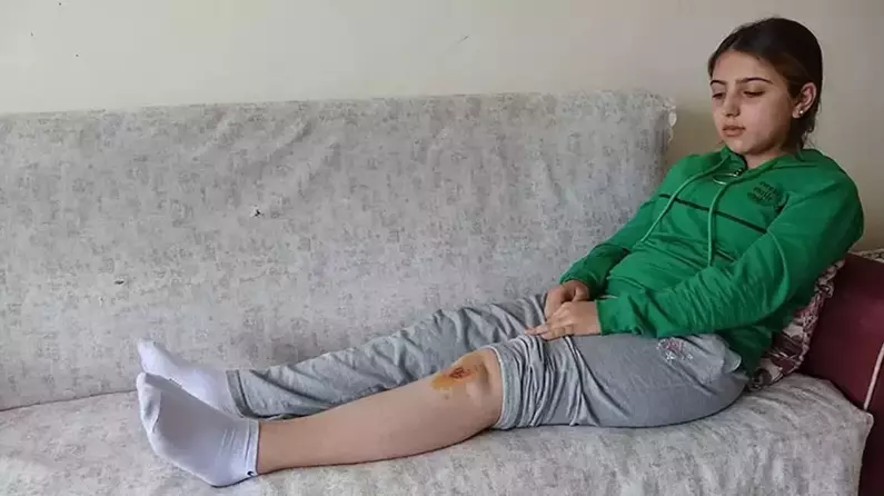 Hakkari'de Liseli Özge, köpeklerin saldırısında yaralandı