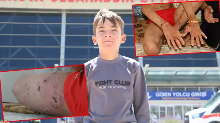 DHA haber yapmıştı; Amar, Ankara'da tedavi olacak