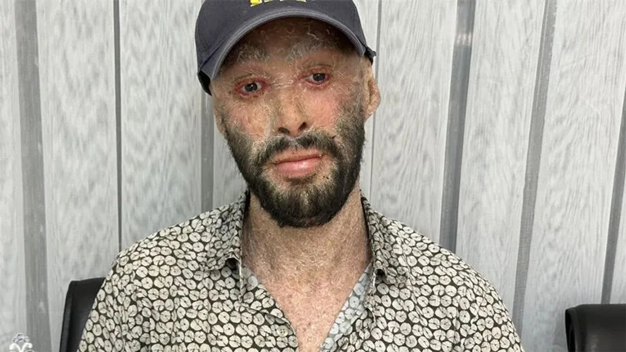 Hakkarili Refik Töre, hayırseverlerden destek bekliyor