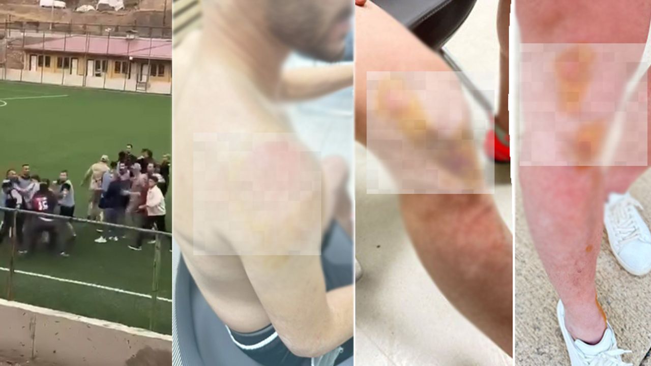 Maçta çıkan kavganın detayları belli oldu: 2 isim şikayetçi oldu