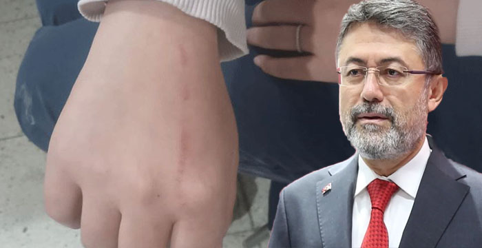 Hakkari'de Veterinerlere saldırı, Bakandan sert tepki!