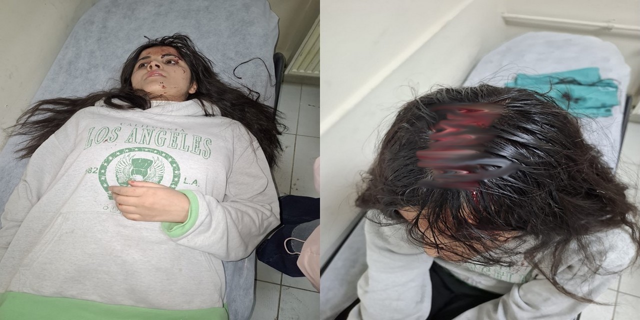 Hakkari’de Genç Kızın Başına Buz Kütlesi Düştü!