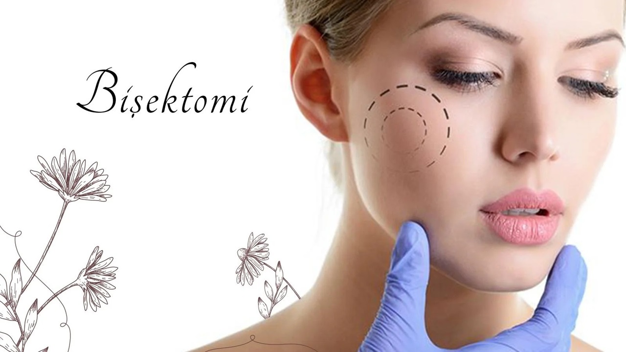 İnce ve Keskin Yüz Hatları İçin Bişektomi Uygulaması