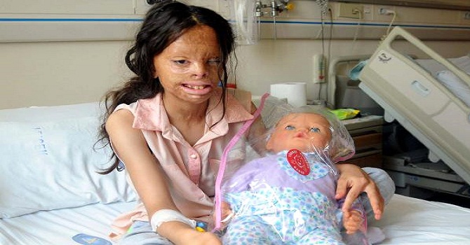 Hayırseverler Serkan ve Firdevs için harekete geçti