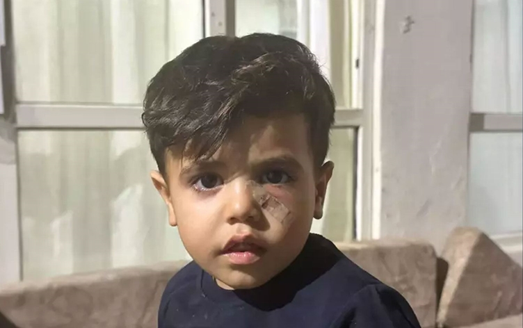 Yorgun mermi 4 yaşındaki çocuğun gözünün altına isabet etti