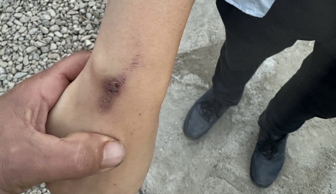 Hakkari’de yabancı turist saldırıya uğradı