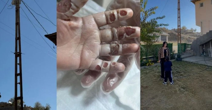 Hakkari'de “Kaldıracağız” Denilen Direk Kaldırılmadı, 4 Yaşındaki Çocuk Akıma Kapıldı