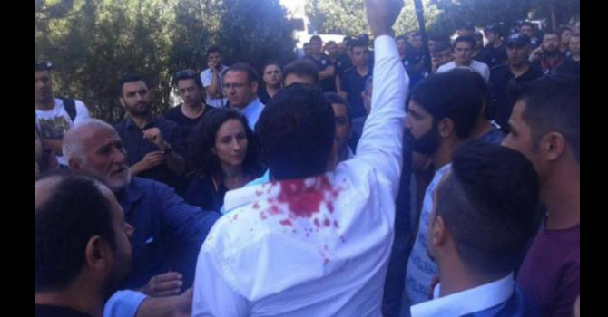 Polis dövdü, “Sizi HDP'liler sandık” dedi