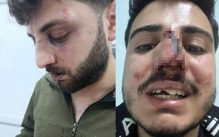 Van’da polisten kardeşlere darp iddiası: Soruşturma jandarmaya devredildi