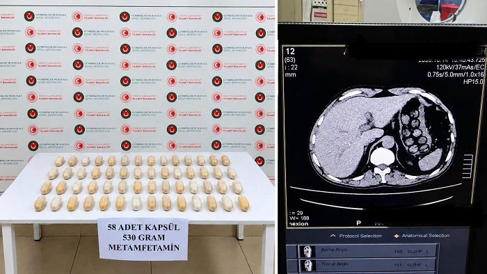 Hakkari'de Mide ve Bağırsaklarından 530 Gram Metamfetamin Çıktı