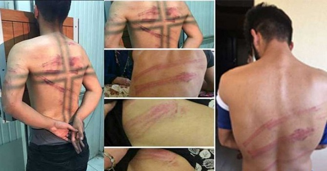 Şemdinli'deki darp iddiasında bir polis görevden uzaklaştırıldı