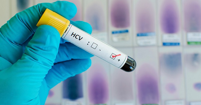 Dünyanın En Düşük Hepatit-C Oranı Şemdinli'de Tespit Edildi"